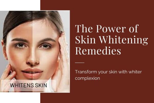 Skin Whitening Remedies